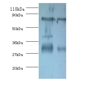 Yolk Immunoglobulin Polyclonal Antibody