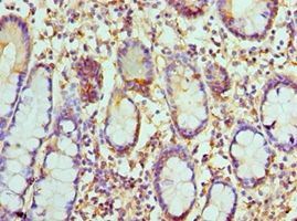 CCL8 Polyclonal Antibody