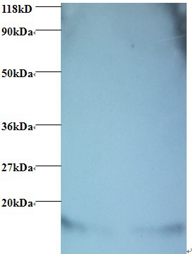 Hemoglobin Polyclonal Antibody