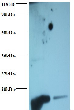 Hemoglobin Polyclonal Antibody