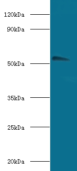 Acetylcholine receptor subunit alpha Polyclonal Antibody