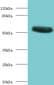 CHRNA1 Polyclonal Antibody