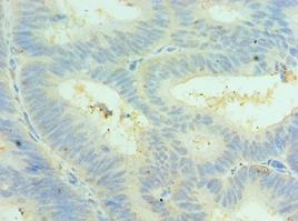 CLIC4 Polyclonal Antibody