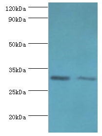 CLIC4 Polyclonal Antibody