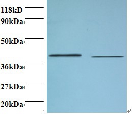 Beta-1,4-galactosyltransferase 3 Polyclonal Antibody