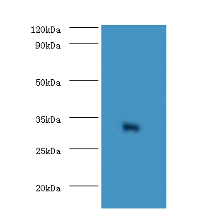 Elongation factor 1-delta Polyclonal Antibody