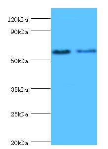 Estrogen receptor beta Polyclonal Antibody