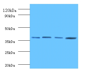 Protein FAM110B Polyclonal Antibody