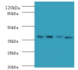 IgG receptor FcRn large subunit p51 Polyclonal Antibody