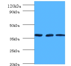 Putative tRNA (cytidine(32)/guanosine(34)-2'-O)-methyltransferase Polyclonal Antibody