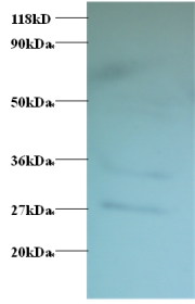 GDP-L-fucose synthase Polyclonal Antibody