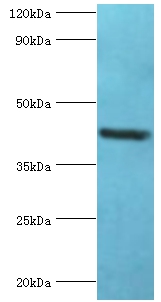 GOLM1 Polyclonal Antibody