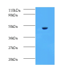 Aspartate aminotransferase, cytoplasmic Polyclonal Antibody