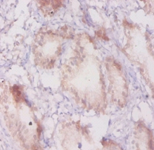 Beta-adrenergic receptor kinase 1 Polyclonal Antibody