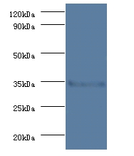 Serine/threonine-protein phosphatase 2A catalytic subunit beta isoform Polyclonal Antibody