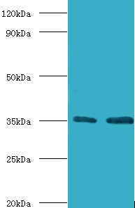 Transcription initiation factor IIB Polyclonal Antibody