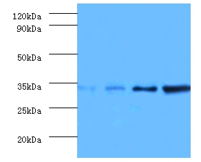 Transcription initiation factor IIE subunit beta Polyclonal Antibody