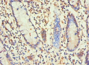 H1F0 Polyclonal Antibody