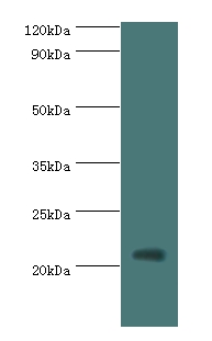 H1F0 Polyclonal Antibody