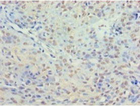 Histone deacetylase 3 Polyclonal Antibody