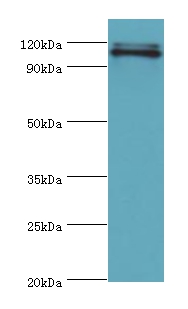 HIP1 Polyclonal Antibody
