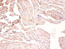 Heterogeneous nuclear ribonucleoprotein A1 Polyclonal Antibody