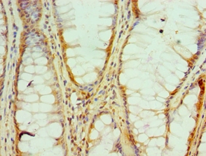 HNRNPM Polyclonal Antibody