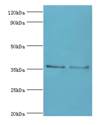 HOXA1 Polyclonal Antibody