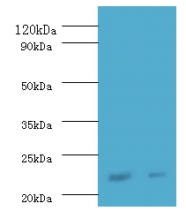 Interferon alpha-21 Polyclonal Antibody