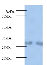 Spermidine synthase Polyclonal Antibody