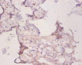 Peroxiredoxin-1 Polyclonal Antibody