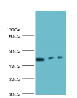 Integrin-linked kinase-associated serine/threonine phosphatase 2C Polyclonal Antibody