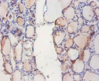 Indolethylamine N-methyltransferase Polyclonal Antibody