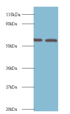 Inosine-5'-monophosphate dehydrogenase 2 Polyclonal Antibody