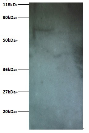 Interferon-induced transmembrane protein 1 Polyclonal Antibody