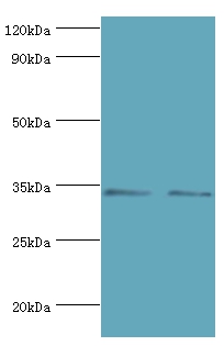 KIR2DS4 Polyclonal Antibody