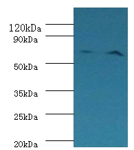 Plasma kallikrein Polyclonal Antibody