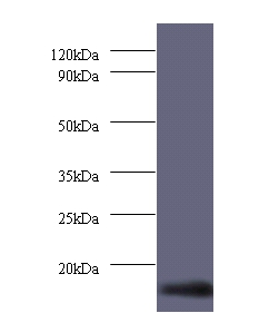 Dynein light chain 1, cytoplasmic Polyclonal Antibody