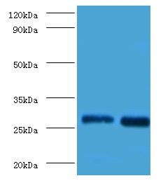 Galectin-3 Polyclonal Antibody