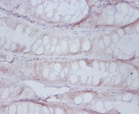 Proteasome subunit beta type-7 Polyclonal Antibody