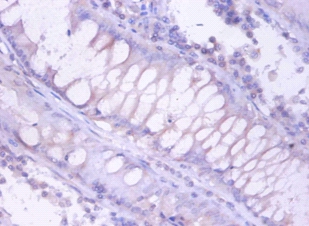 Proteasome subunit beta type-4 Polyclonal Antibody