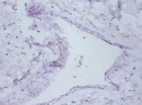 Prefoldin subunit 5 Polyclonal Antibody