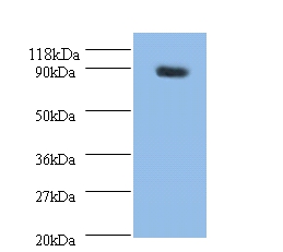 Rho guanine nucleotide exchange factor 7 Polyclonal Antibody