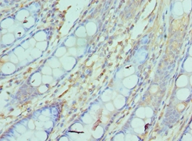 NCBP2 Polyclonal Antibody