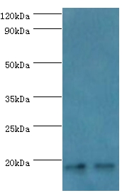 NCBP2 Polyclonal Antibody