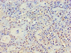 Cytoplasmic protein NCK2 Polyclonal Antibody