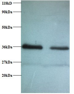 Replication protein A 32 kDa subunit Polyclonal Antibody