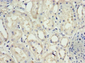 Nephrin Polyclonal Antibody