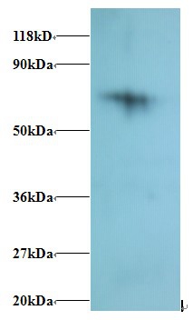 40S ribosomal protein S18 Polyclonal Antibody