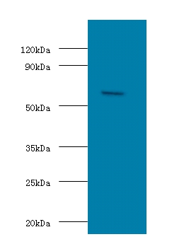 Succinyl-CoA:3-ketoacid coenzyme A transferase 1, mitochondrial Polyclonal Antibody